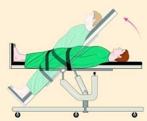 Low sensitivity of abbreviated tilt table testing for diagnosing ...