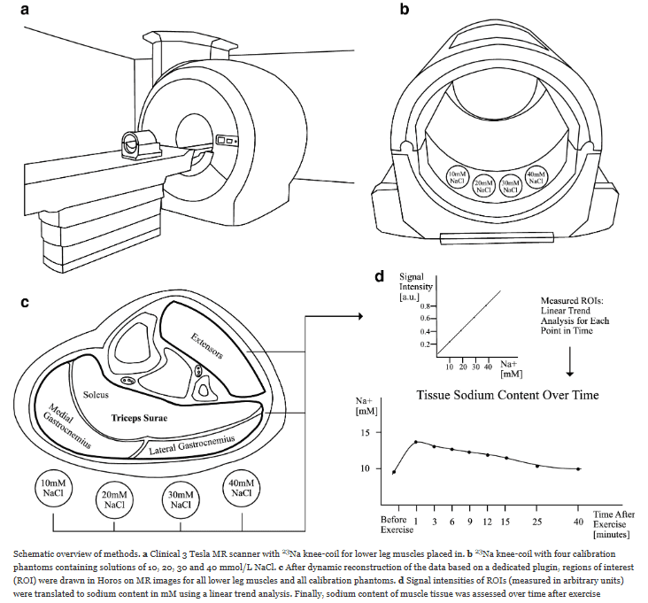 Research: Muscle sodium overload in patients with ME/CFS | WAMES ...